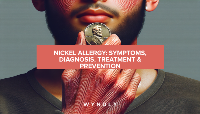 Nickel Allergy: Identifying Symptoms and Effective Treatment Options ...
