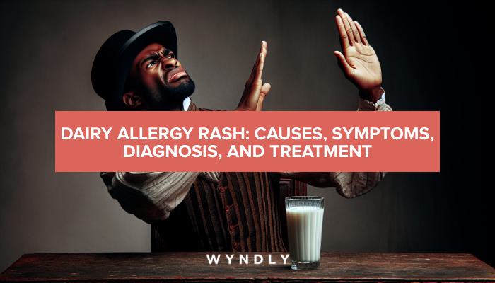 Dairy Allergy Rash: Causes, Symptoms, and Treatment Guide 2025 & Wyndly