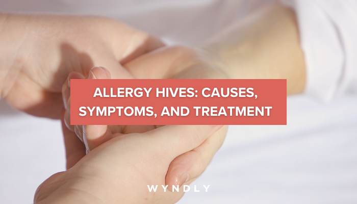 Allergy Hives Causes Symptoms And Treatment 2023 Wyndly allergy-hives-causes-symptoms-and-treatment-2023-wyndly
