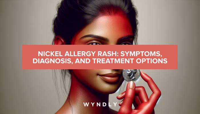 Nickel Allergy Rash: Identifying Symptoms and Treatment Options 2025 ...