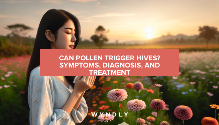 Pollen Allergies: Can They Trigger Hives? Diagnosis & Treatment 2025 ... 